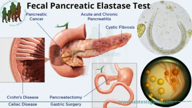 pancreatic elastase