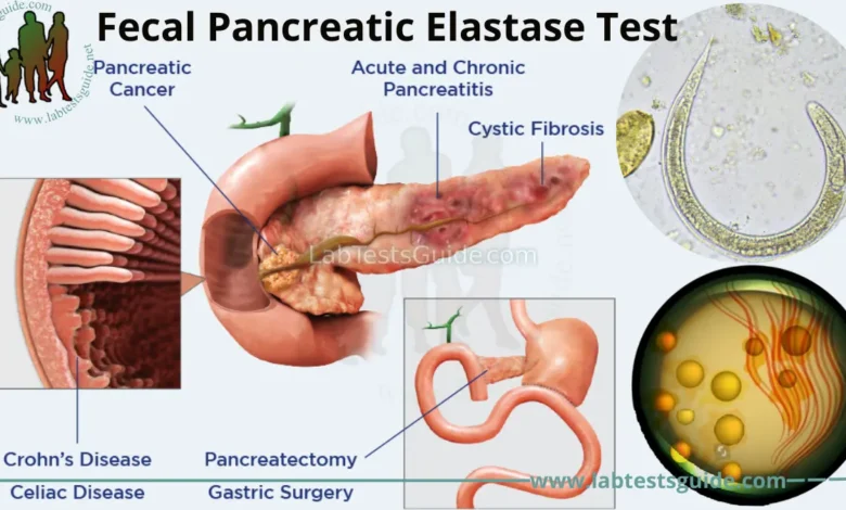 pancreatic elastase