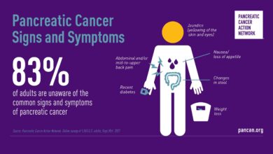 pancreatic cancer symptoms